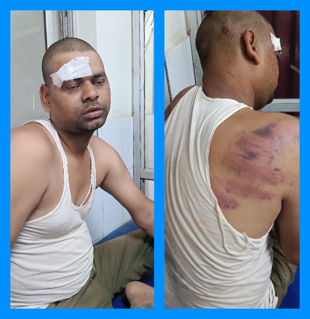 पोकलेन ऑपरेटर ने नाबालिक लड़की के साथ किया छेड़खानी,ग्रामीणों ने जमकर पीटा चालक का मेदिनीराय मेडिकल कॉलेज अस्पताल में चल रहा है इलाज