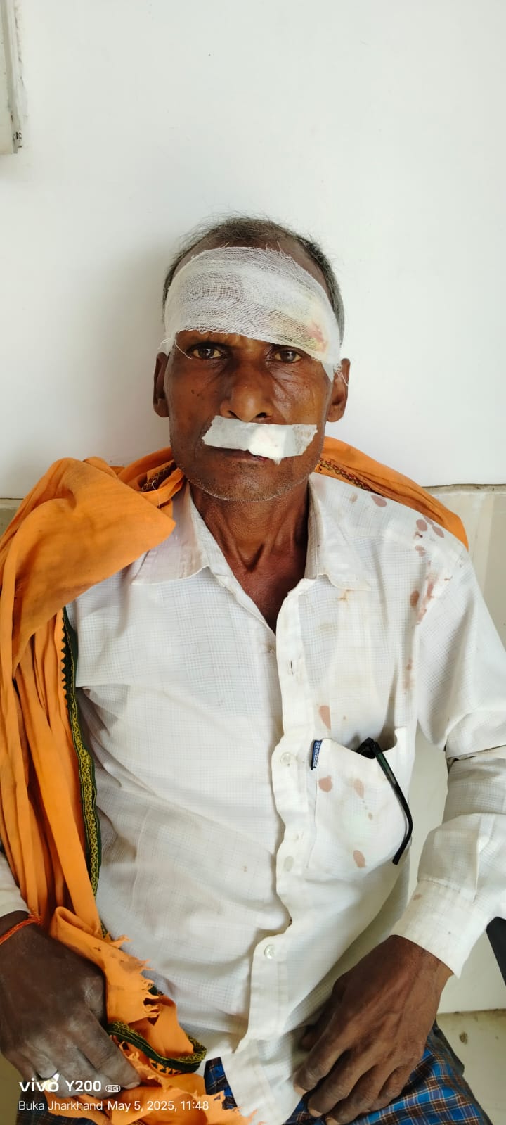 जमीनी विवाद को लेकर साले और बहनोई के बीच मारपीट, एक घायल
