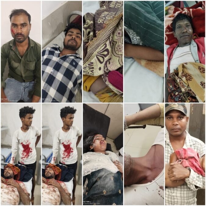 भवनाथपुर में सड़क हादसा, बिजली गिरना और आपसी विवाद समेत चार अलग-अलग घटनाओं में 13 से अधिक लोग घायल, कई रेफर