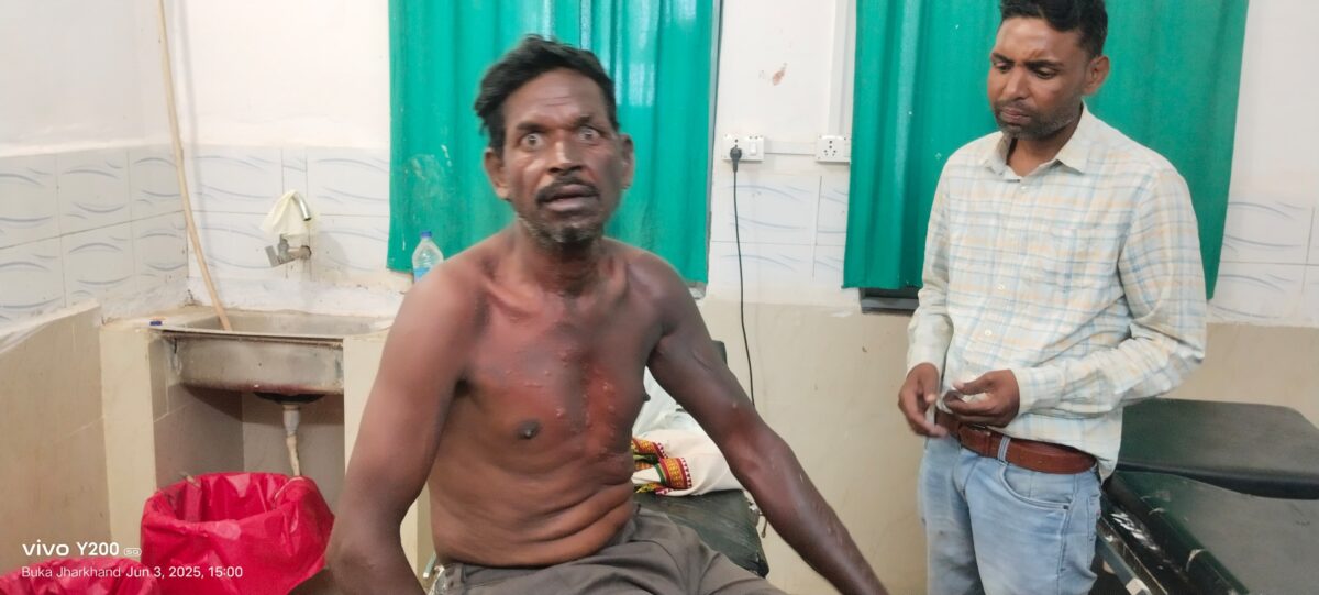 गैस सिलेंडर में आग लगने से युवक झुलसा, सीएचसी में कराया गया भर्ती