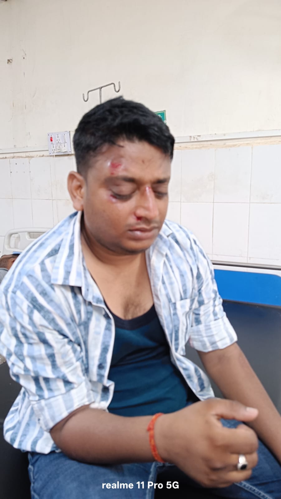अज्ञात वाहन के धक्के से 30 वर्षीय व्यक्ति घायल,हालत गंभीर