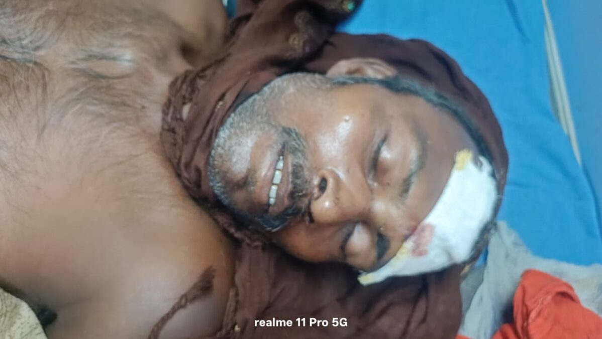 जमीन विवाद मामले को लेकर 55 वर्षीय व्यक्ति को पीटकर किया घायल,हालत गंभीर