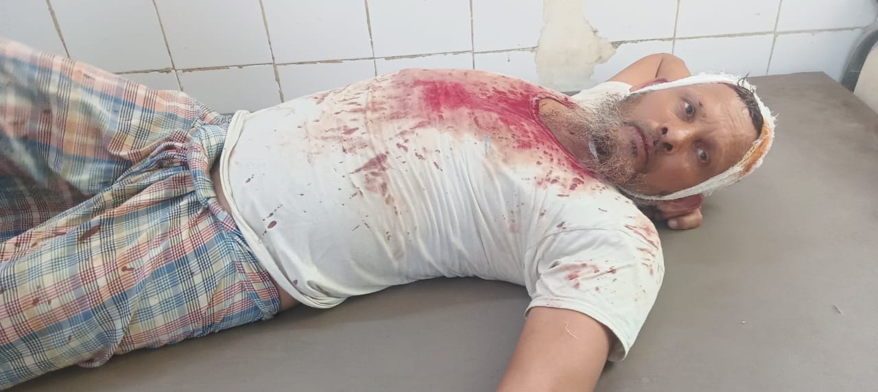 जलमीनार विवाद को लेकर दो गांवों में मारपीट, तीन घायल, दो गढ़वा रेफर