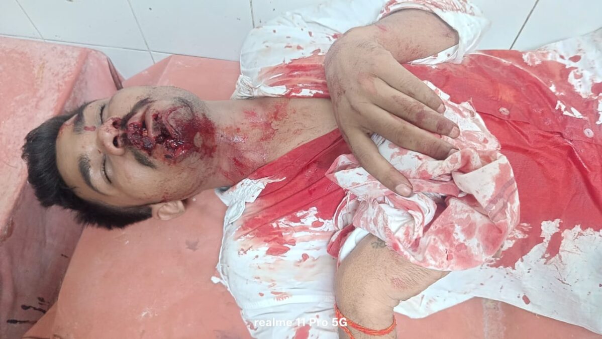अज्ञात कार के धक्के से 28 वर्षीय युवक घायल,हालत गंभीर