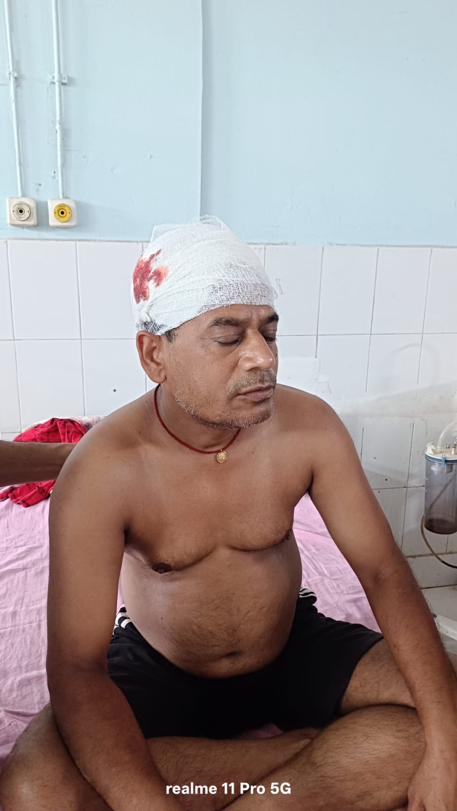 बिजली का तार जोड़ने के क्रम में छत से गिरकर 40 वर्षीय व्यक्ति घायल,हालत गंभीर