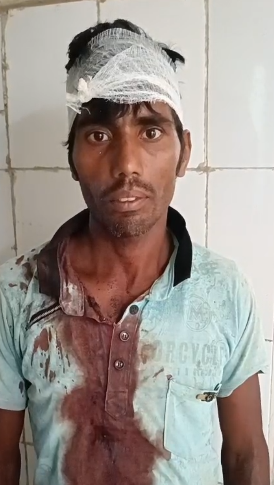 आम तोड़ने को लेकर हुई विवाद में सास,दामाद और बेटी गंभीर रूप से घायल