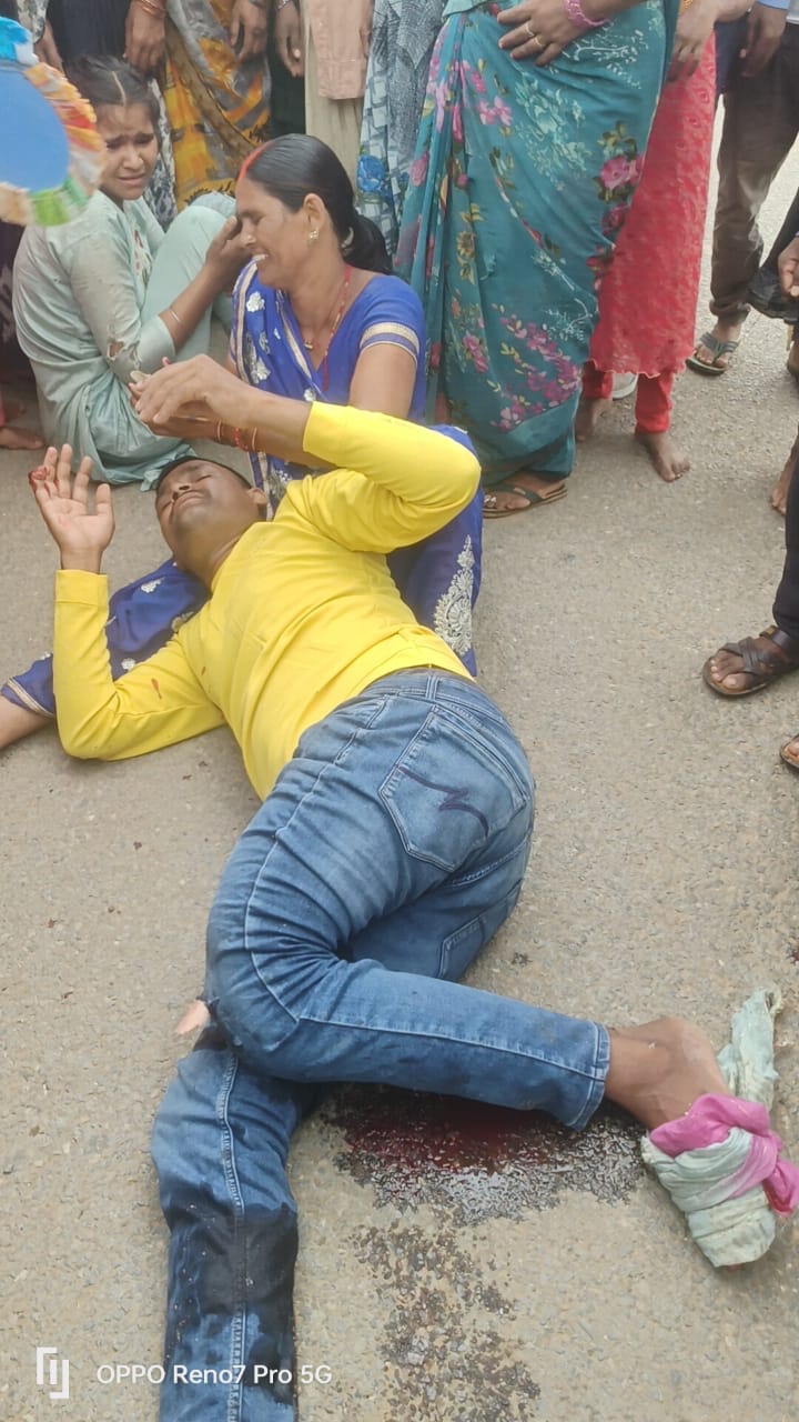 सगमा में दो बाइक की आमने-सामने भिड़ंत, चार घायल, एक की हालत गंभीर