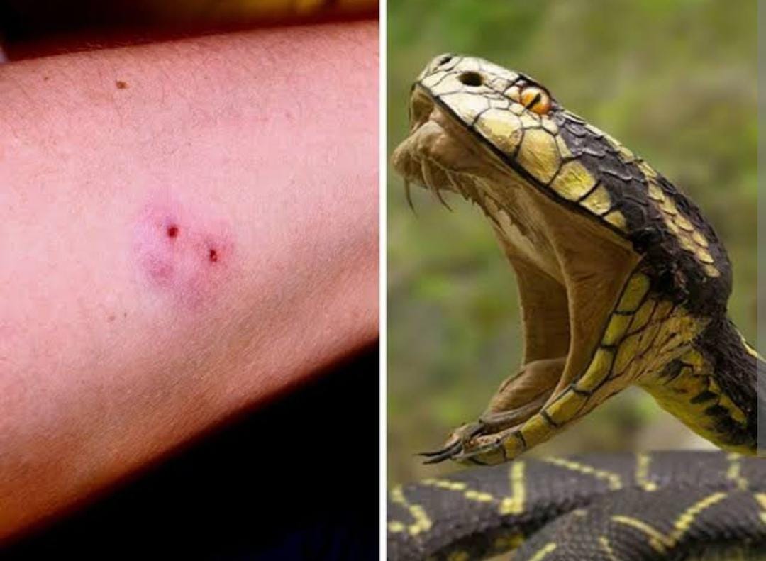 पिता और पुत्र को सांप ने काटकर किया घायल हालत गंभीर