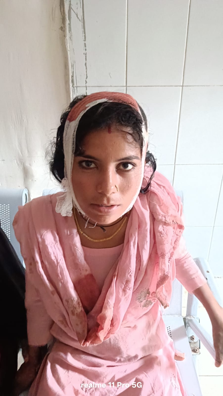 महिला ने महिला को लोहे के छड़ से पीट कर किया घायल,हालत गंभीर