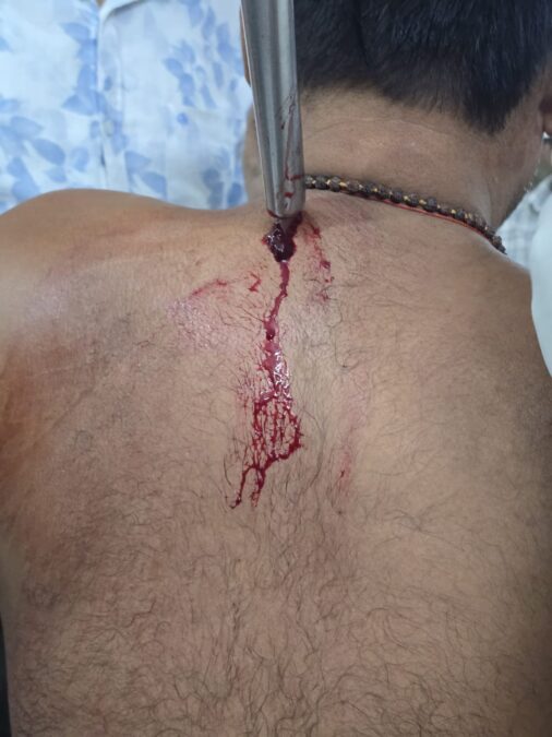 रंगदारी नहीं देने पर दुकानदार को चाकू मारकर किया घायल, हालत गंभीर