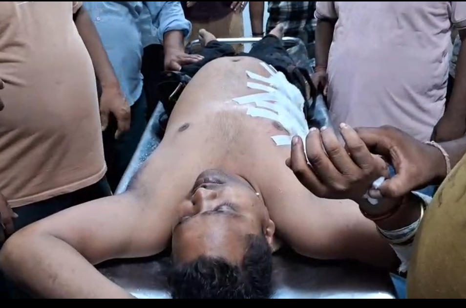 रतनलाल ऑटो बाइक्स शोरूम के कर्मचारी के पेट में घुसा सीसा ,गंभीर रूप से घायल।