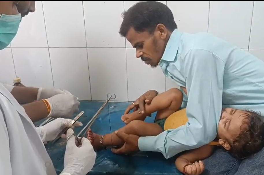 आरी ब्लेड से कटकर दो वर्षीय बच्ची घायल हालत गंभीर