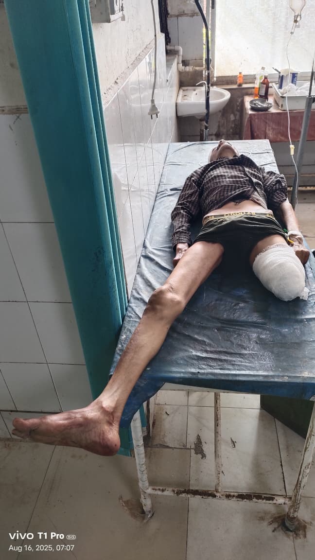 ट्रेन की चपेट में आकर 50 वर्षीय व्यक्ति घायल हालत गंभीर