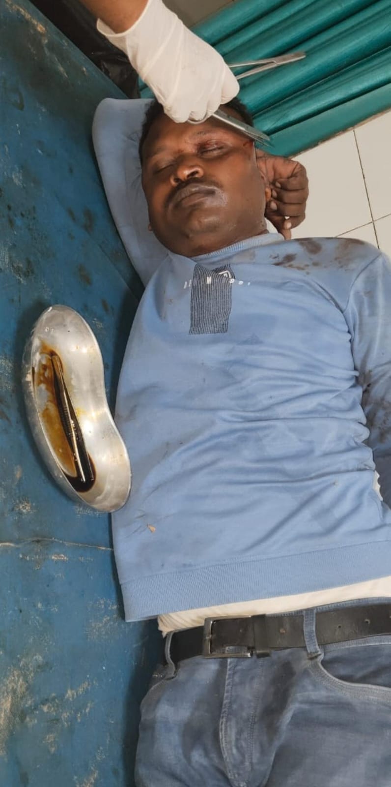 व्यक्ति के ऊपर गिरा पीपल का पेड़,हालत गंभीर, पुलिस ने पहुंचाया अस्पताल।