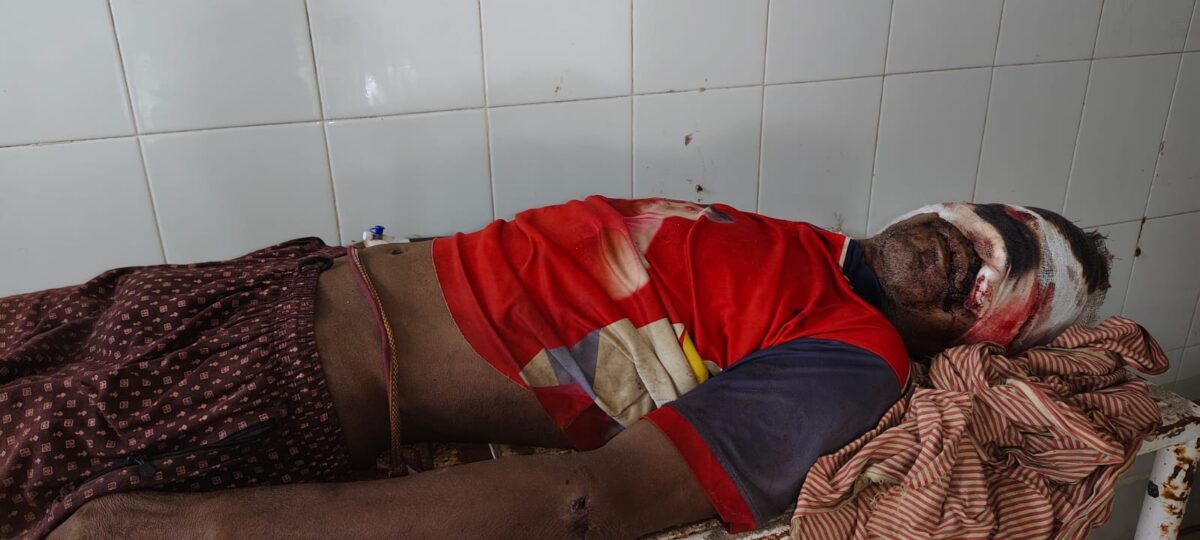 मामूली विवाद में 55 वर्षीय व्यक्ति की  हत्या