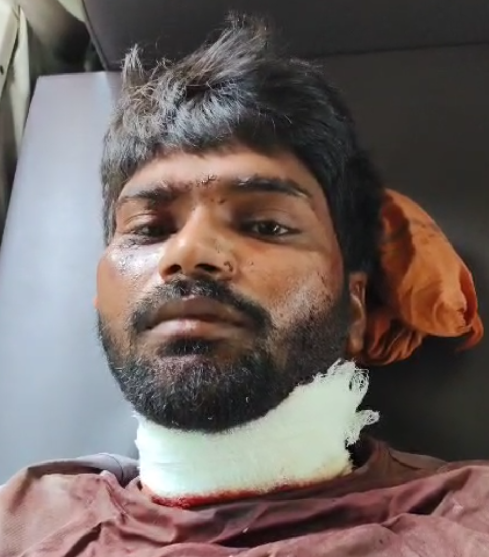ब्रेकिंग न्यूज :  लुटेरों ने ब्लेड से गला काटकर युवक को किया घायल रांची रेफर,मामले की जांच में जुटी पुलिस