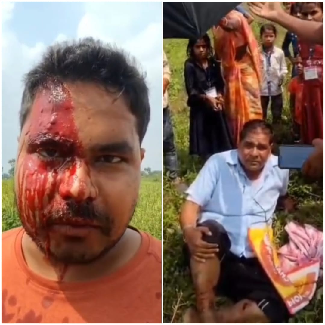 नौडीहा बाजार के शाहपुर पंचायत के मुखिया पति ने पिता पुत्र को पीट कर किया घायल हालत गंभीर
