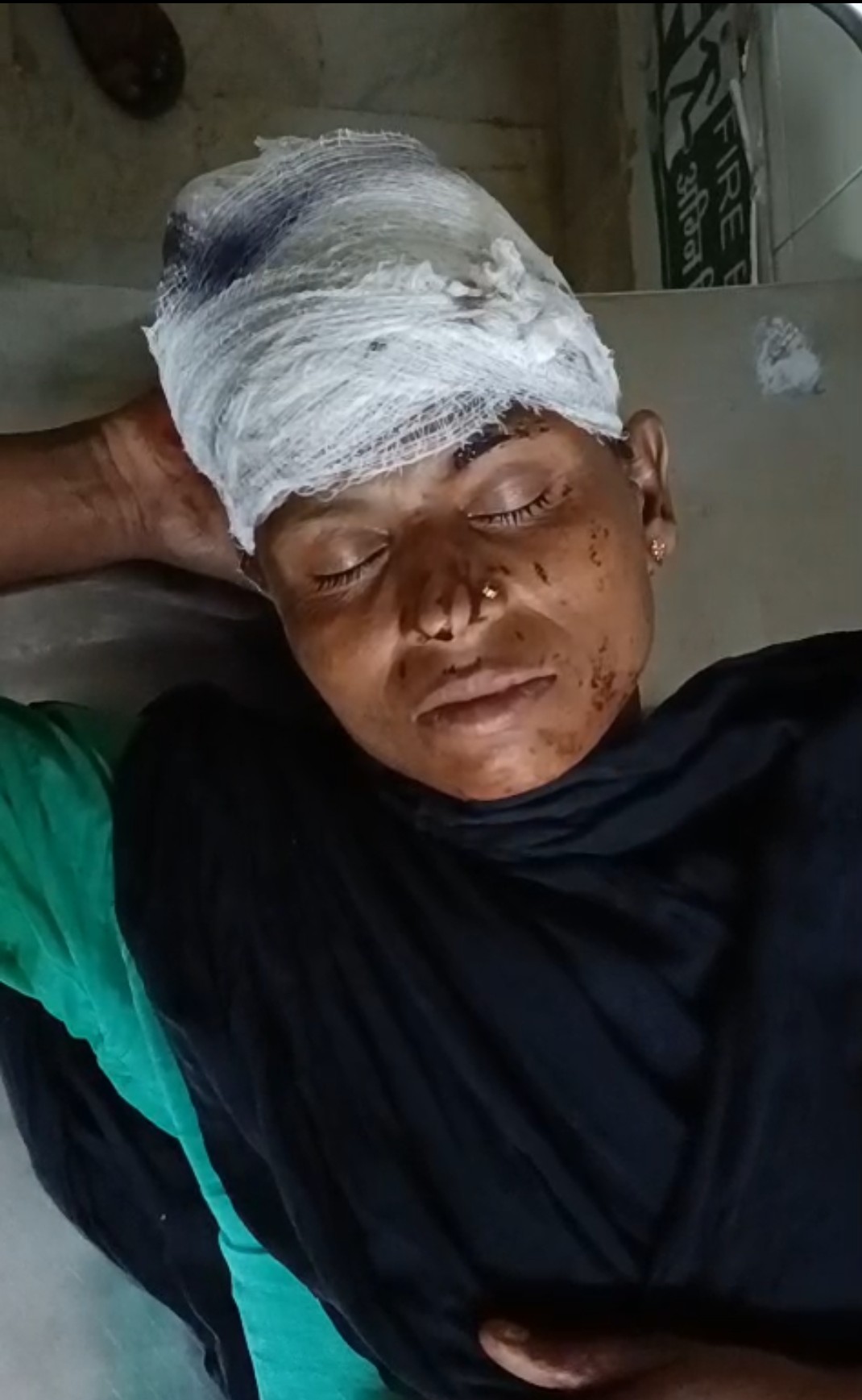 जमीन विवाद को लेकर दो पक्षों के बीच हुई मारपीट में पति घायल पत्नी गंभीर रूप से घायल,हालत गंभीर