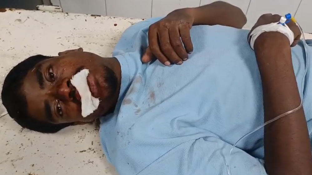 दो बाइक की आमने-सामने की टक्कर में दो युवक घायल एक की हालत गंभीर