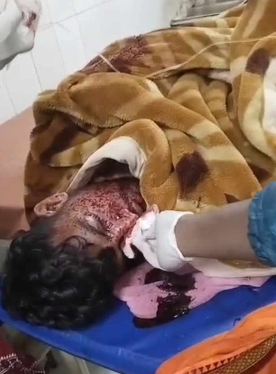 चतरा गोलीबारी की घटना में दो व्यक्ति की घटनास्थल पर मौत,चार व्यक्ति गंभीर रूप से घायल