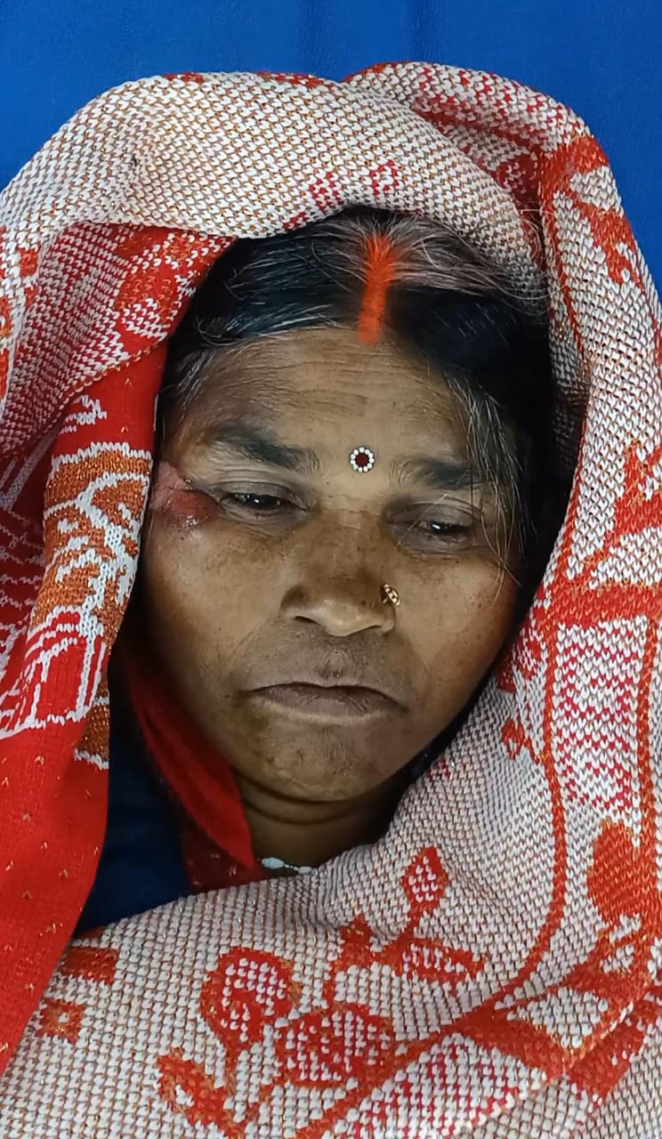 बस की चपेट में आकर गढ़वा की 45 वर्षीय महिला घायल हालत गंभीर