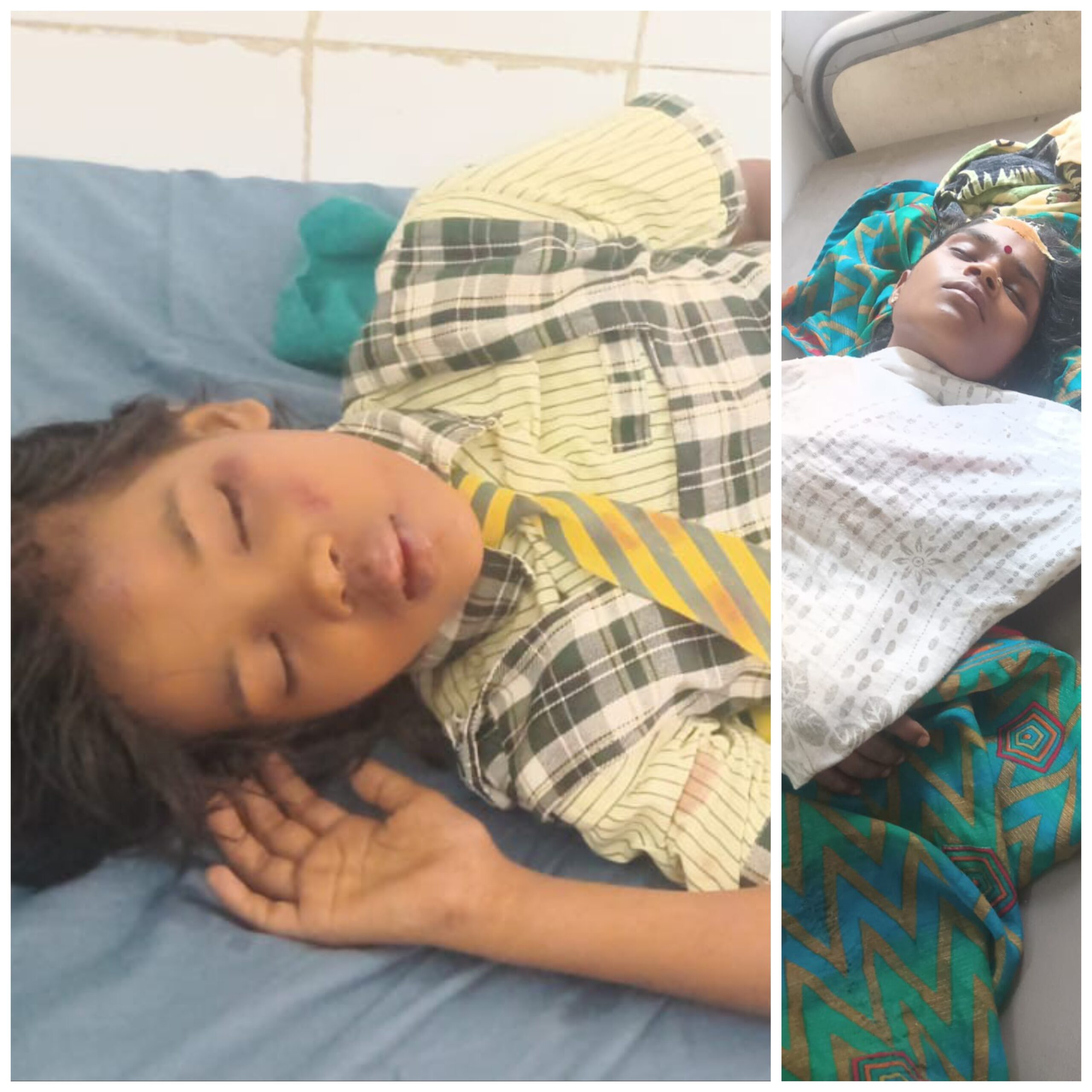 तेज रफ्तार बाइक की टक्कर से छात्रा गंभीर रूप से घायल, तीन अन्य भी जख्मी