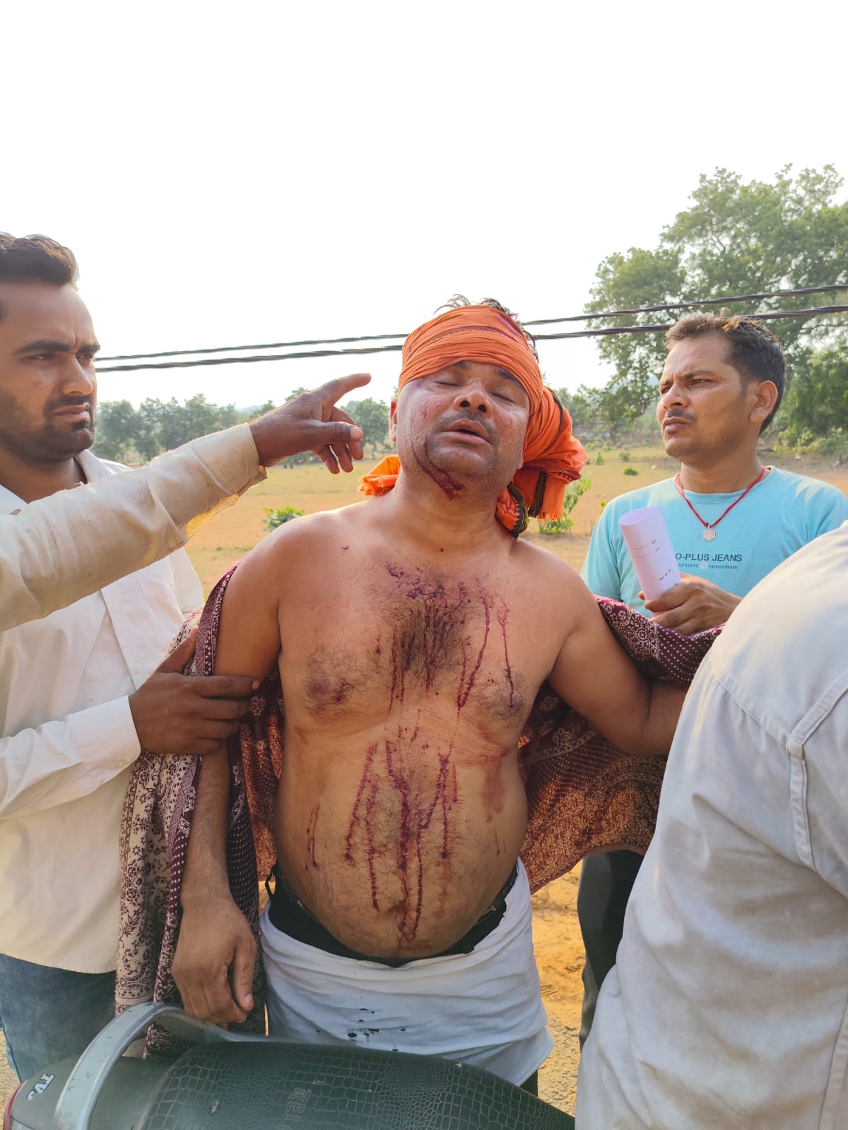 जमीन विवाद में बेटे ने पिता व भाई पर टांगी से किया हमला, दोनों गंभीर रूप से घायल