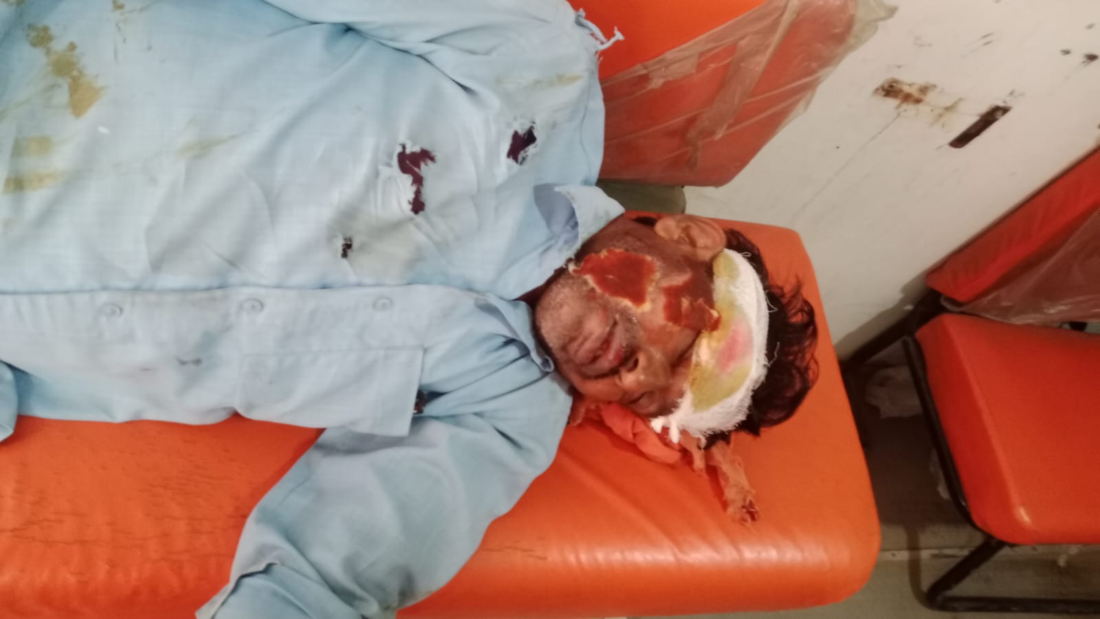 मझिआंव-गढ़वा मुख्य पथ पर नीलगाय से टकराई बाइक, तीन मजदूर घायल